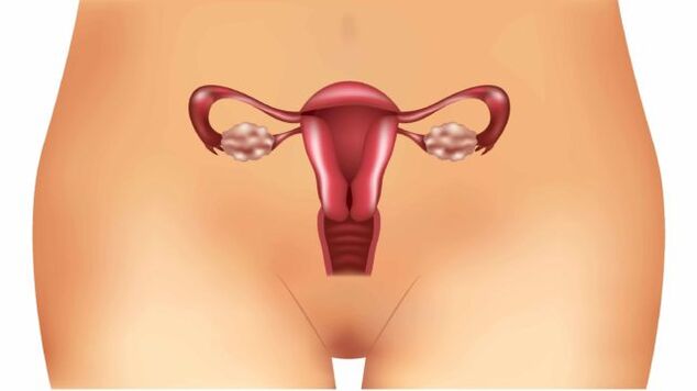 varicose veins sa uterus