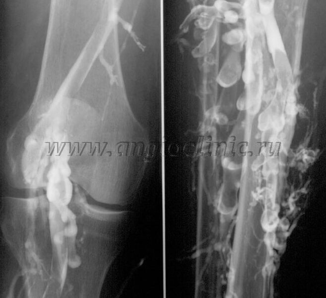 Pag-scan sa ultrasound